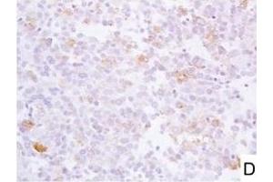 Image no. 13 for anti-L1 Cell Adhesion Molecule (L1CAM) (AA 1-1120) antibody (ABIN1995799)