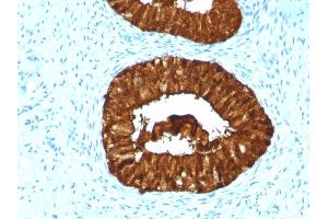 Image no. 2 for anti-Mastermind-Like 3 (MAML3) antibody (ABIN6940389)