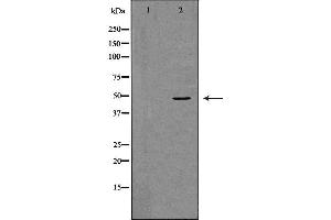 Image no. 1 for anti-Tumor Necrosis Factor Receptor Superfamily, Member 11b (TNFRSF11B) (Internal Region) antibody (ABIN6265637)