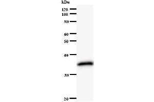 Image no. 2 for anti-Origin Recognition Complex, Subunit 6 (ORC6) antibody (ABIN931160)