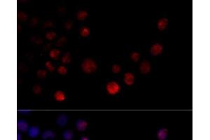 Immunofluorescence analysis of 293T cells using HNRNPH2 Polyclonal Antibody at dilution of 1:100 (40x lens).