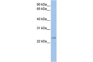 Image no. 1 for anti-FK506 Binding Protein 3, 25kDa (FKBP3) (C-Term) antibody (ABIN2785798)