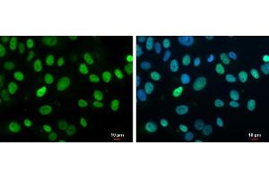 ICC/IF Image Rb antibody detects Rb protein at nucleus by immunofluorescent analysis.