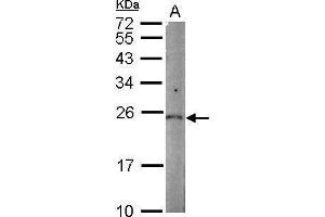 WB Image Sample (50 ug of whole cell lysate) A: mouse kidney 12% SDS PAGE antibody diluted at 1:1000