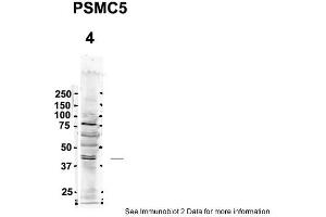 Image no. 1 for anti-Proteasome (Prosome, Macropain) 26S Subunit, ATPase, 5 (PSMC5) (C-Term) antibody (ABIN2780449)