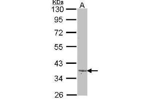 Image no. 1 for anti-Left-Right Determination Factor 2 (LEFTY2) (Center) antibody (ABIN2855096)