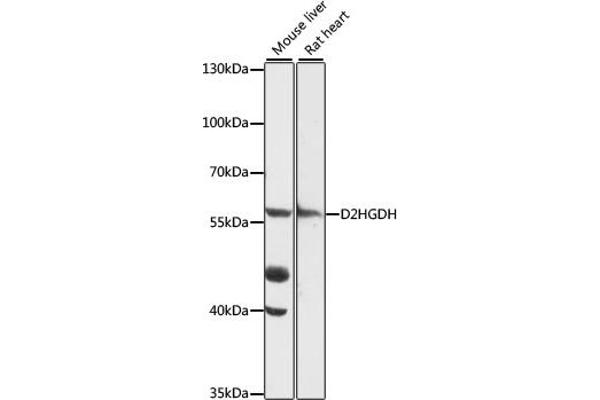 D2HGDH anticorps  (AA 322-521)