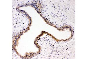 Image no. 2 for anti-Neurotrophic tyrosine Kinase, Receptor, Type 3 (NTRK3) (AA 172-186), (N-Term) antibody (ABIN3042961)
