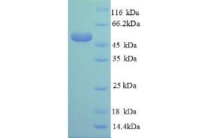 Image no. 1 for Ribosomal Protein L14 (RPL14) (AA 2-214), (partial) protein (GST tag) (ABIN5712063)