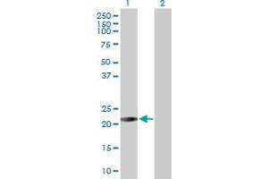 Image no. 1 for anti-RAB26, Member RAS Oncogene Family (RAB26) (AA 1-190) antibody (ABIN525458)