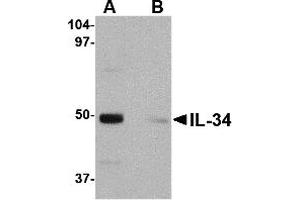 Image no. 1 for anti-Interleukin 34 (IL34) (Middle Region) antibody (ABIN1030960)
