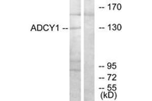 Image no. 1 for anti-Adenylate Cyclase 1 (Brain) (ADCY1) (AA 231-280) antibody (ABIN1534252)