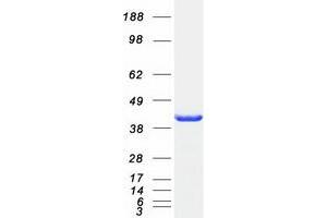 Image no. 1 for ADP-Ribosylation Factor Interacting Protein 2 (ARFIP2) protein (Myc-DYKDDDDK Tag) (ABIN2714860)
