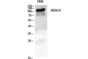 Image no. 2 for anti-Histone Deacetylase 4 (HDAC4) (Tyr493) antibody (ABIN3184987)