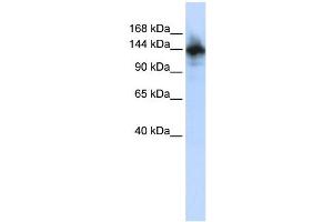 Image no. 1 for anti-RNA Binding Motif Protein 6 (RBM6) (N-Term) antibody (ABIN2777313)