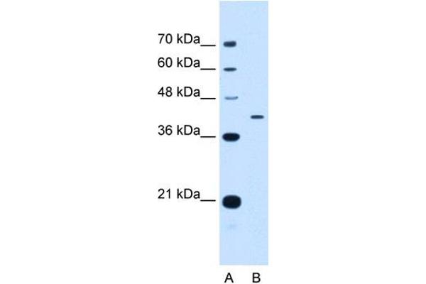 anti-Apolipoprotein H (Beta-2-Glycoprotein I) (APOH) (N-Term) antibody