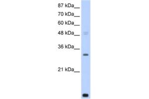 Image no. 1 for anti-CCR4-NOT Transcription Complex, Subunit 7 (CNOT7) antibody (ABIN2461842)