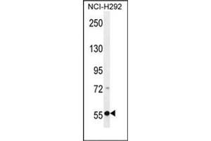Image no. 1 for anti-Excision Repair Cross-Complementing Rodent Repair Deficiency, Complementation Group 6-Like 2 (ERCC6L2) (AA 233-263), (Middle Region) antibody (ABIN954432)