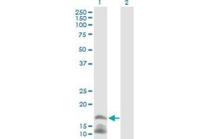 Image no. 2 for anti-Cathelicidin Antimicrobial Peptide (CAMP) (AA 1-170) antibody (ABIN513995)
