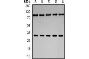 Image no. 1 for anti-Neuroglobin (NGB) antibody (ABIN3197739)