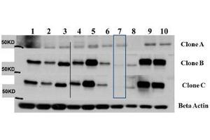 Image no. 2 for anti-V-Akt Murine Thymoma Viral Oncogene Homolog 3 (Protein Kinase B, Gamma) (AKT3) (Internal Region) antibody (Biotin) (ABIN5596896)