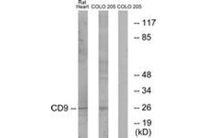 Image no. 1 for anti-CD9 (CD9) (AA 101-150) antibody (ABIN1534314)