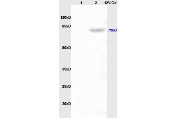 P-Cadherin antibody  (AA 625-725)