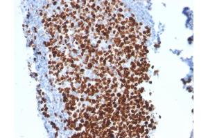 Image no. 4 for anti-Antigen Identified By Monoclonal Antibody Ki-67 (MKI67) (AA 2293-2478) antibody (ABIN6940053)
