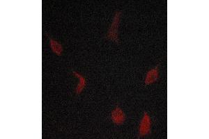 Image no. 2 for anti-Transforming Growth Factor, beta Receptor 1 (TGFBR1) (Internal Region) antibody (ABIN6265544)