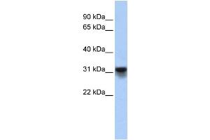 Image no. 1 for anti-KDEL (Lys-Asp-Glu-Leu) Endoplasmic Reticulum Protein Retention Receptor 3 (kDELR3) (Middle Region) antibody (ABIN2782741)