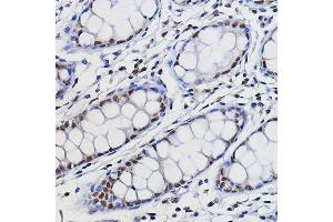 Immunohistochemistry of paraffin-embedded human colon using METTL14 Rabbit pAb (ABIN6131104, ABIN6143759, ABIN6143760 and ABIN6224625) at dilution of 1:100 (40x lens).