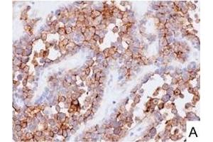 Image no. 10 for anti-L1 Cell Adhesion Molecule (L1CAM) (AA 1-1120) antibody (ABIN1995799)