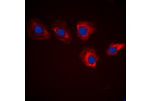 MARK3 antibody  (N-Term)