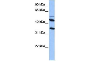Image no. 1 for anti-Interleukin 13 Receptor, alpha 2 (IL13RA2) (Middle Region) antibody (ABIN636087)
