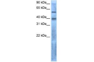 Image no. 3 for anti-Left-Right Determination Factor 2 (LEFTY2) (N-Term) antibody (ABIN2777146)