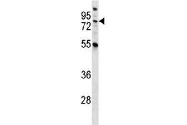 MST1 anticorps  (AA 454-483)