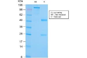 Image no. 1 for anti-Heat Shock Protein 90kDa beta (Grp94), Member 1 (HSP90B1) antibody (ABIN6940801)