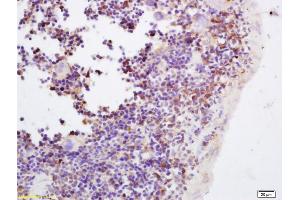 Image no. 1 for anti-Janus Kinase 3 (JAK3) (pTyr980), (pTyr981) antibody (ABIN742883)