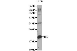 Image no. 2 for anti-BH3 Interacting Domain Death Agonist (BID) antibody (ABIN3020688)