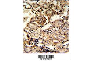Image no. 2 for anti-Guanine Monophosphate Synthetase (GMPS) (Center) antibody (ABIN2437724)