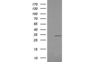 Image no. 4 for anti-Retinoic Acid Receptor Responder (Tazarotene Induced) 1 (RARRES1) antibody (ABIN1500600)