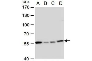 WB Image TCP1 eta antibody [C1C3] detects TCP1 eta protein by western blot analysis.