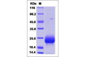 Image no. 1 for Follicle Stimulating Hormone, beta Polypeptide (FSHB) (AA 1-129) protein (His tag) (ABIN2215507)