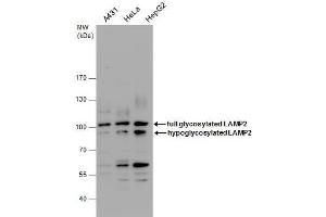 Image no. 3 for anti-Lysosomal-Associated Membrane Protein 2 (LAMP2) (Center) antibody (ABIN2855580)