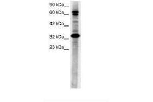 Image no. 3 for anti-TGF-beta Activated Kinase 1/MAP3K7 Binding Protein 2 (TAB2) (N-Term) antibody (ABIN6735781)