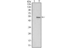 Image no. 3 for anti-SUZ12 Polycomb Repressive Complex 2 Subunit (SUZ12) antibody (ABIN969427)