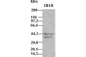 Image no. 3 for anti-DNA Fragmentation Factor, 45kDa, alpha Polypeptide (DFFA) (AA 1-331) antibody (ABIN2719431)