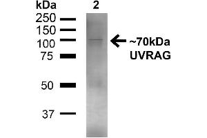 Image no. 2 for anti-UV Radiation Resistance Associated Gene (UVRAG) (C-Term) antibody (Alkaline Phosphatase (AP)) (ABIN2868801)