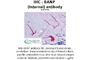 BANP antibody  (Internal Region)