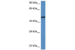 Image no. 1 for anti-SWI/SNF Related, Matrix Associated, Actin Dependent Regulator of Chromatin, Subfamily D, Member 3 (SMARCD3) (C-Term) antibody (ABIN929056)